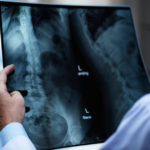 5 Reasons To Consider Outpatient Orthopedic Surgery